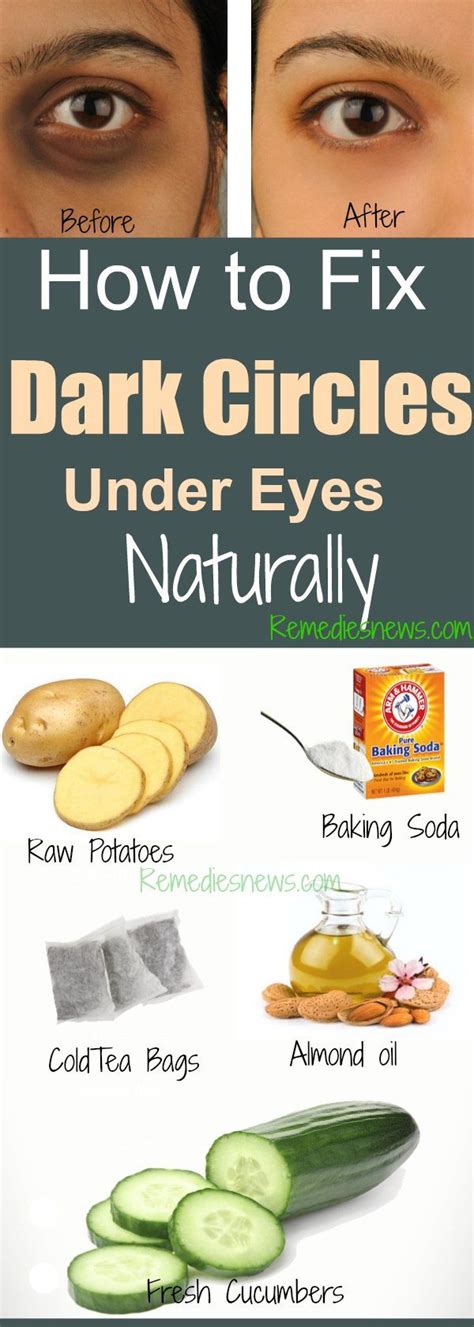 What Helps With Dark Under Eyes