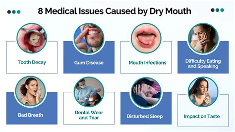 What Helps With Dry Mouth