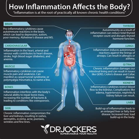 What Helps With Inflammation In The Body