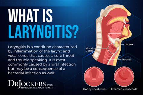 What Helps With Laryngitis