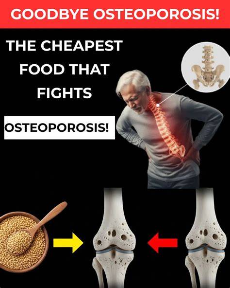 What Helps With Osteoporosis