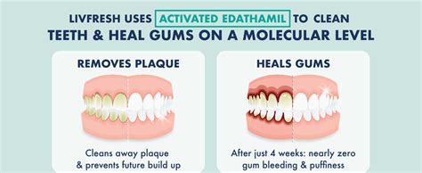 What Improves Gum Health