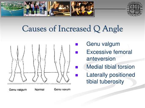 What Increased Q Angle