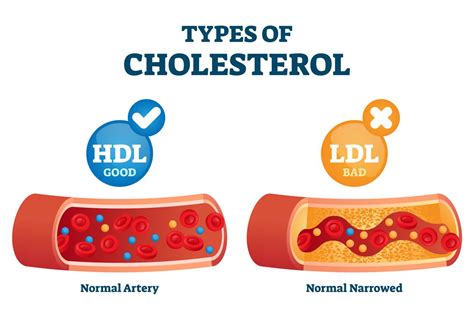 What Increases Ldl Cholesterol