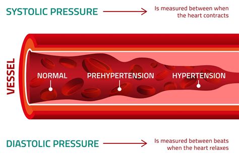 What Increases Systolic Blood Pressure