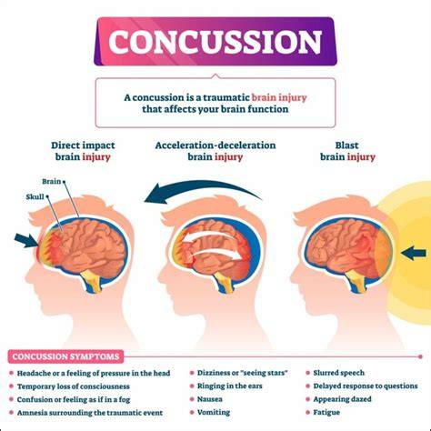 What Is A Concussion