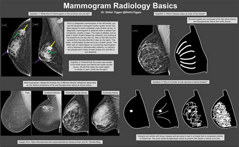 What Is A Diagnostic Mammogram