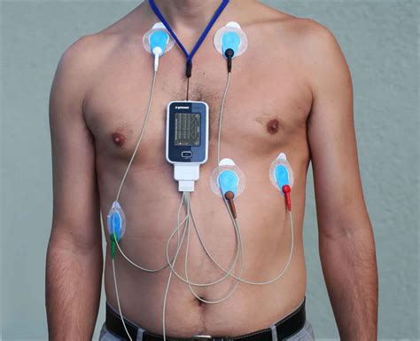 What Is A Holter Monitor