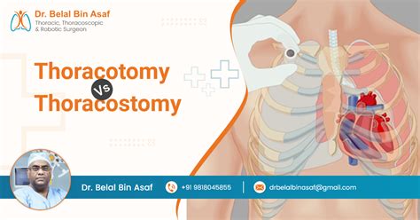 What Is A Thoracotomy