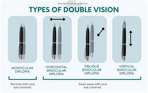 What Is Double Vision