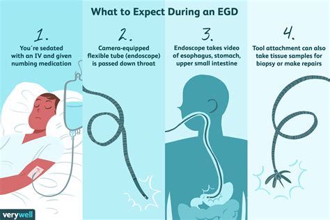 What Is Egd