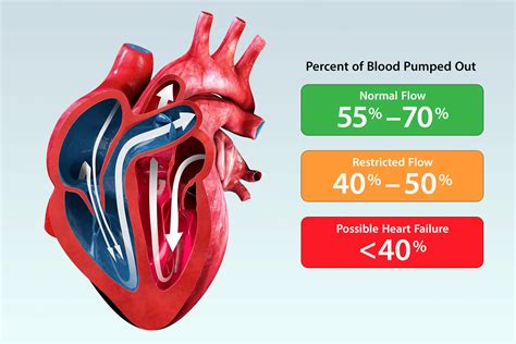 What Is Ejection Fraction