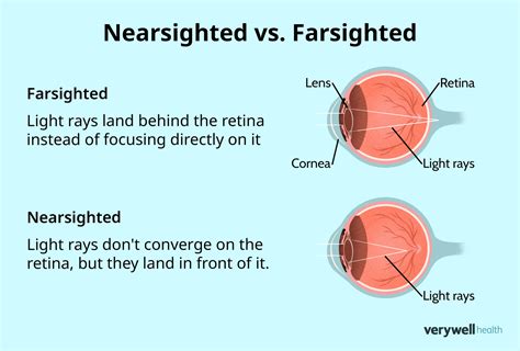 What Is Far Sighted
