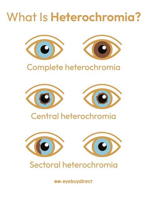 What Is Heterochromia