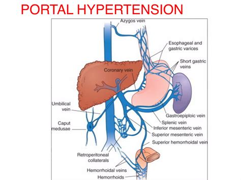 What Is Portal Hypertension