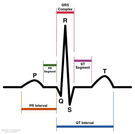 What Is Qt Interval