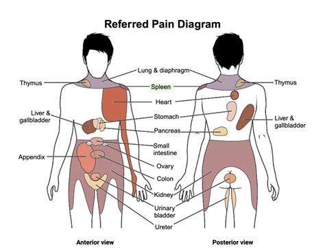 What Is Referred Pain