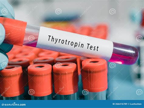 What Is Thyrotropin Test
