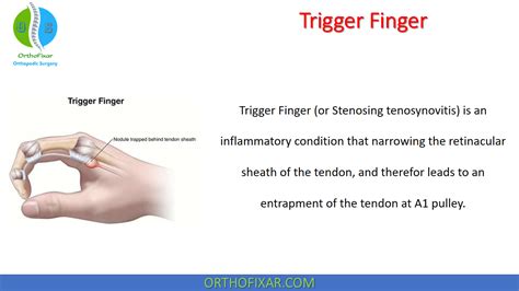 What Is Trigger