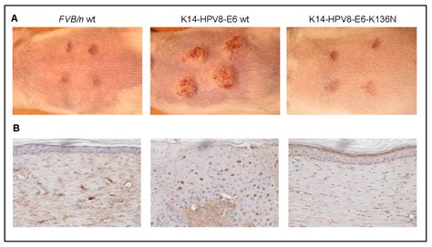 What Kills Hpv Virus On Skin