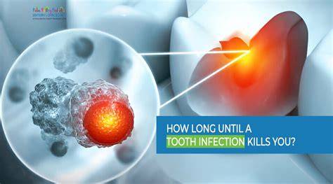 What Kills Infection