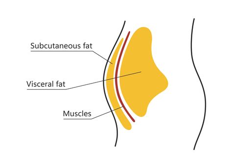 What Kills Subcutaneous Fat