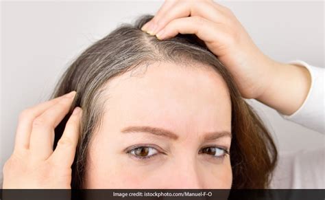 What Prevents Gray Hair