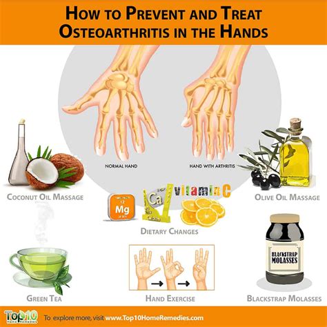What Prevents Osteoarthritis