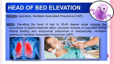 What Prevents Vap