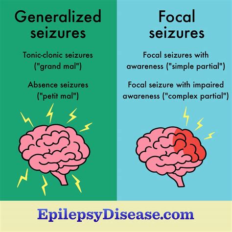 What Triggers Focal Seizures