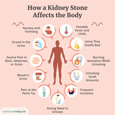 What Triggers Kidney Stone Attack