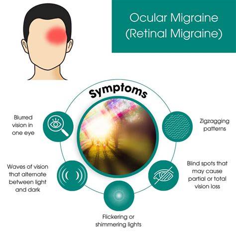 What Triggers Ocular Migraine Headaches
