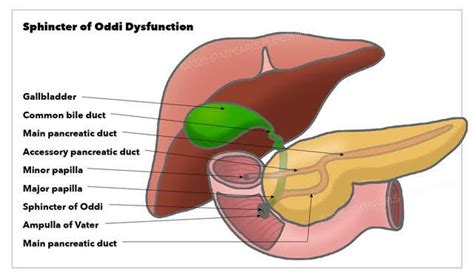 What Triggers Sphincter Of Oddi Pain