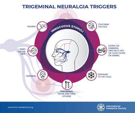 What Triggers Trigeminal Neuralgia