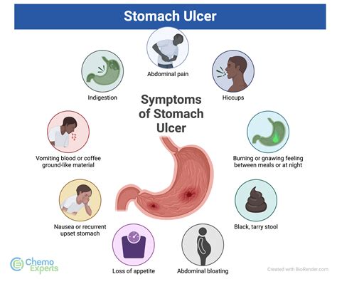 What Triggers Ulcer Pain