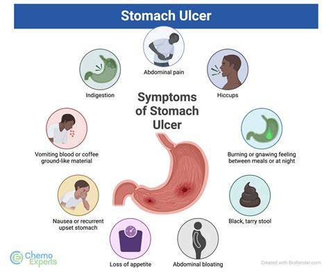 What Triggers Ulcers