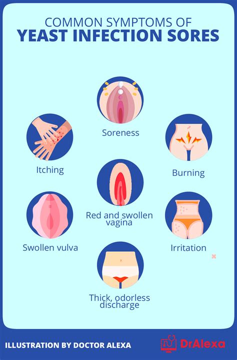 What Triggers Yeast Infection