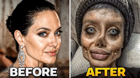 What's Wrong With Yasmin Vesuvian Face Surgery