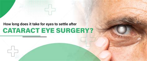 When Does Happen After Cataract Surgery