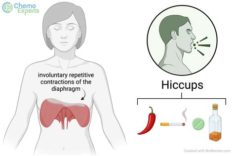 When Does Hiccups Happen