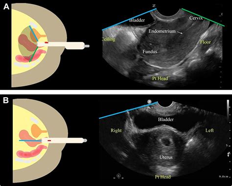 When Was Ultrasound Discovered
