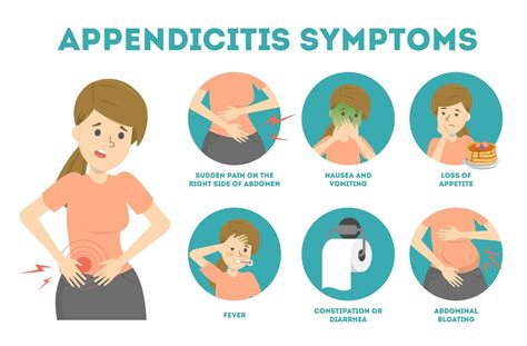 Where Is Appendix Pain Located