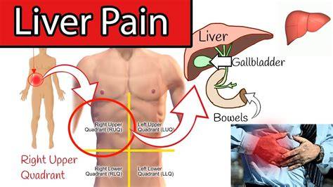 Where Is Liver Pain Located
