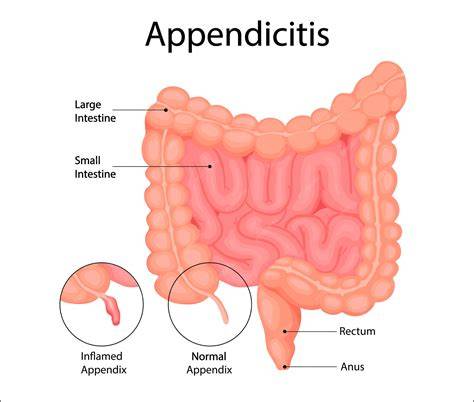 Where Is Located Appendix
