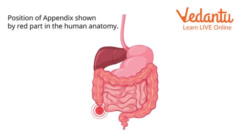 Where's The Appendix