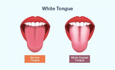 White Tongue Means