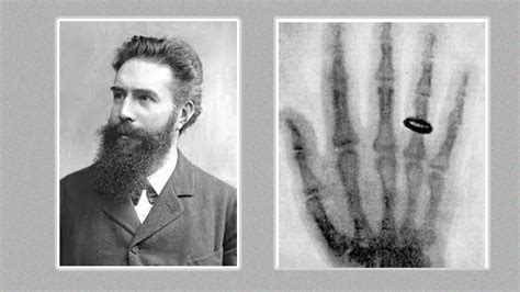 Who Discovered X Body