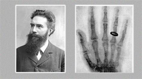Who Invented Xrays
