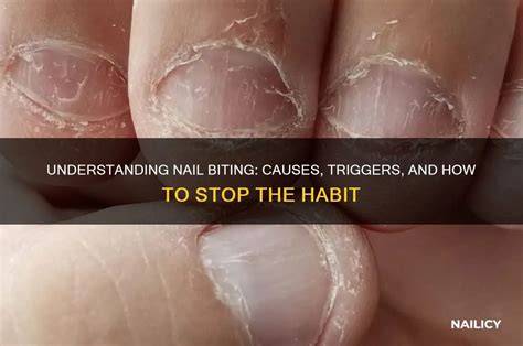 Why Do People Bite Their Nails