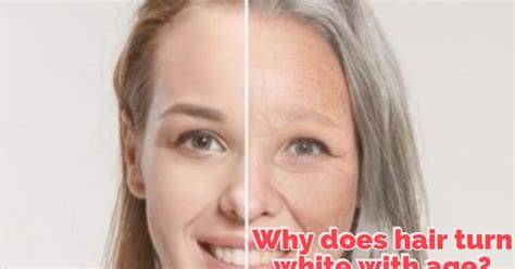 Why Does Hair Turn White